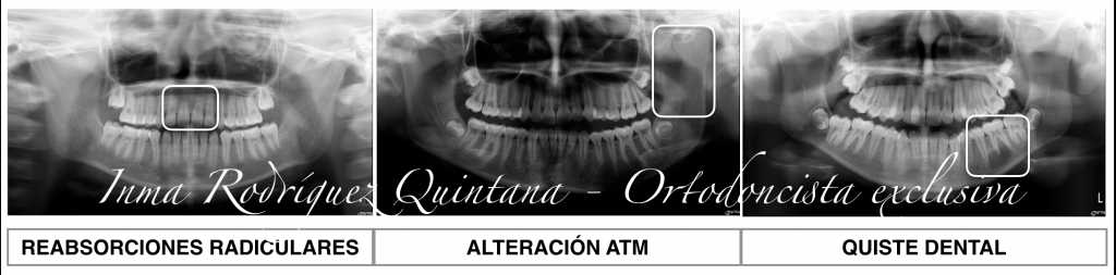 estudio-ortodoncista-carballo