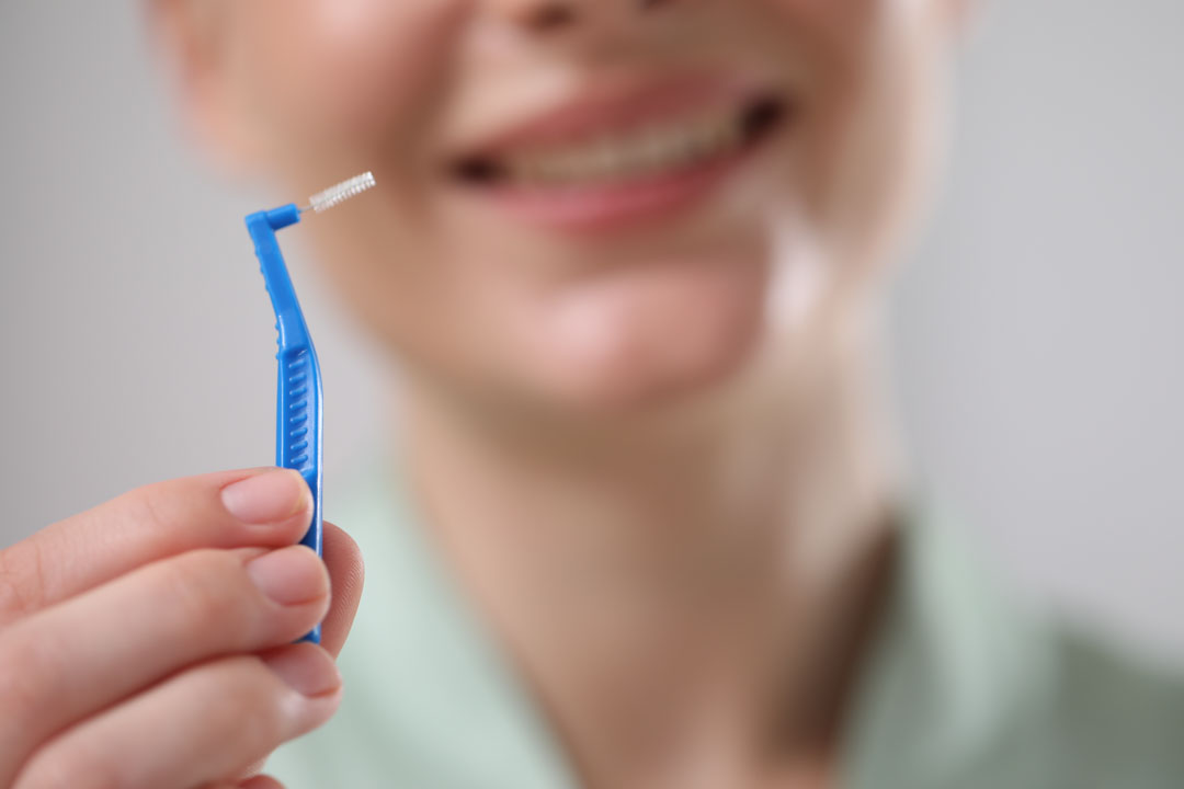 como-usar-cepillo-interdental