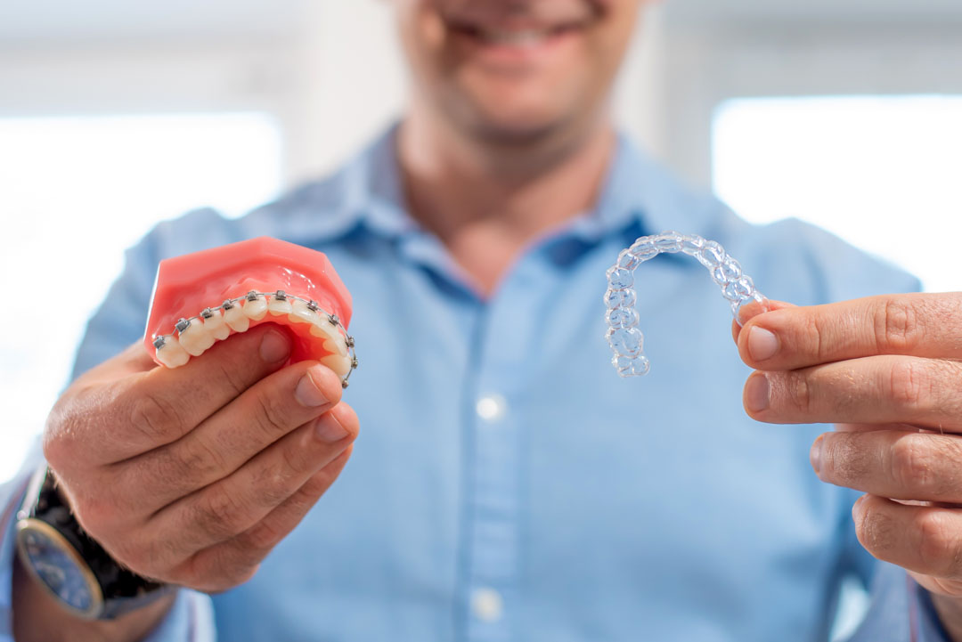 brackets-o-invisalign