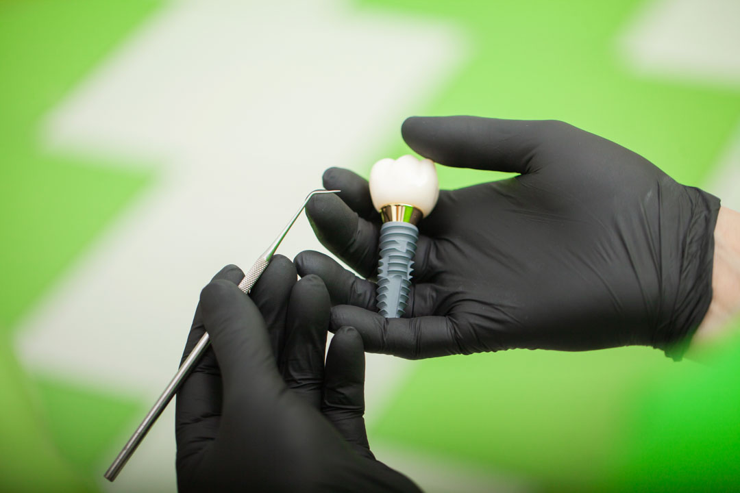 alexandre-pico-implantes-dentales
