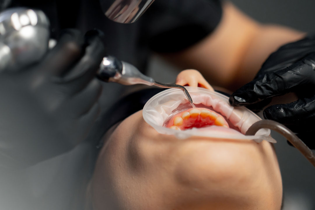 periodoncia-higienstas-dentales-galicia