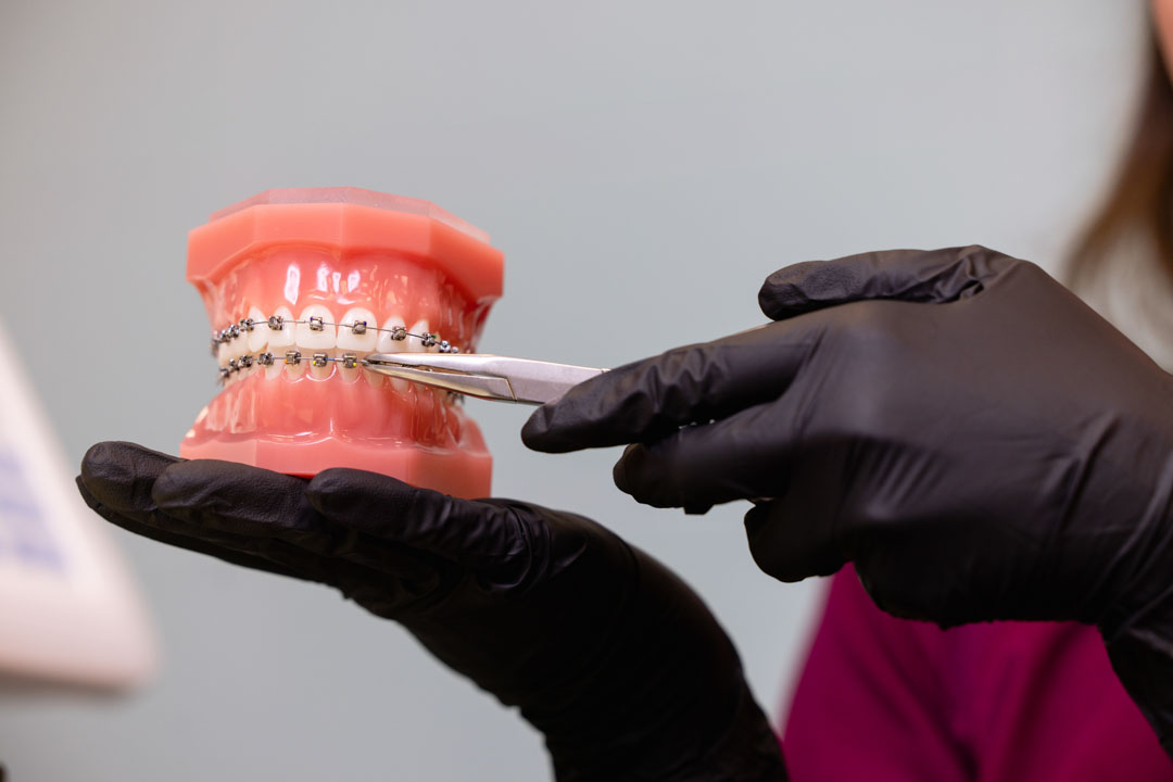 mejor-edad-ponerse-brackets