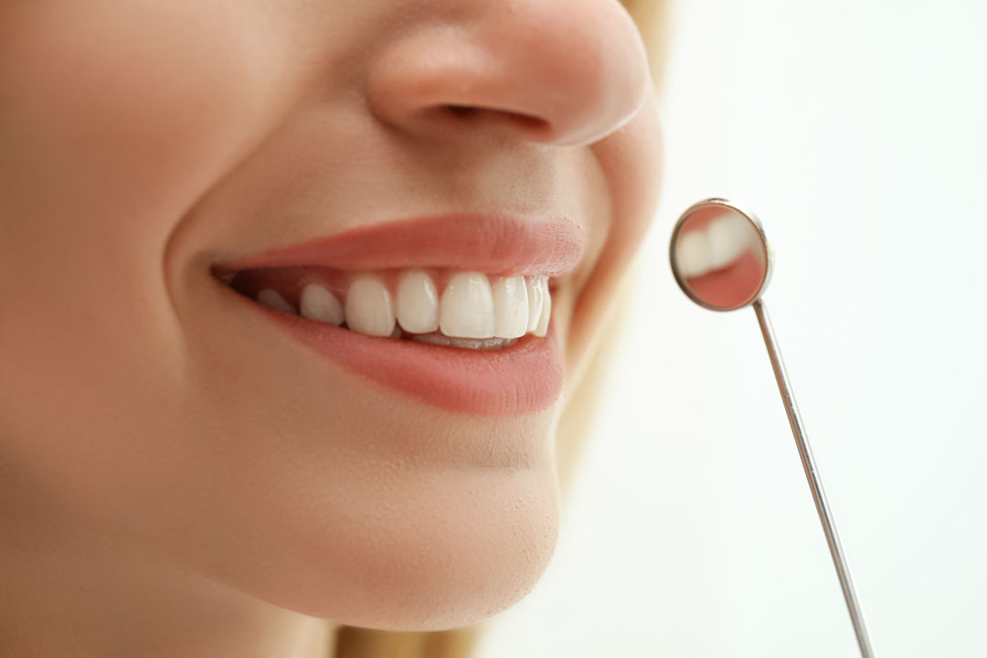 diseño-sonrisa-carballo
